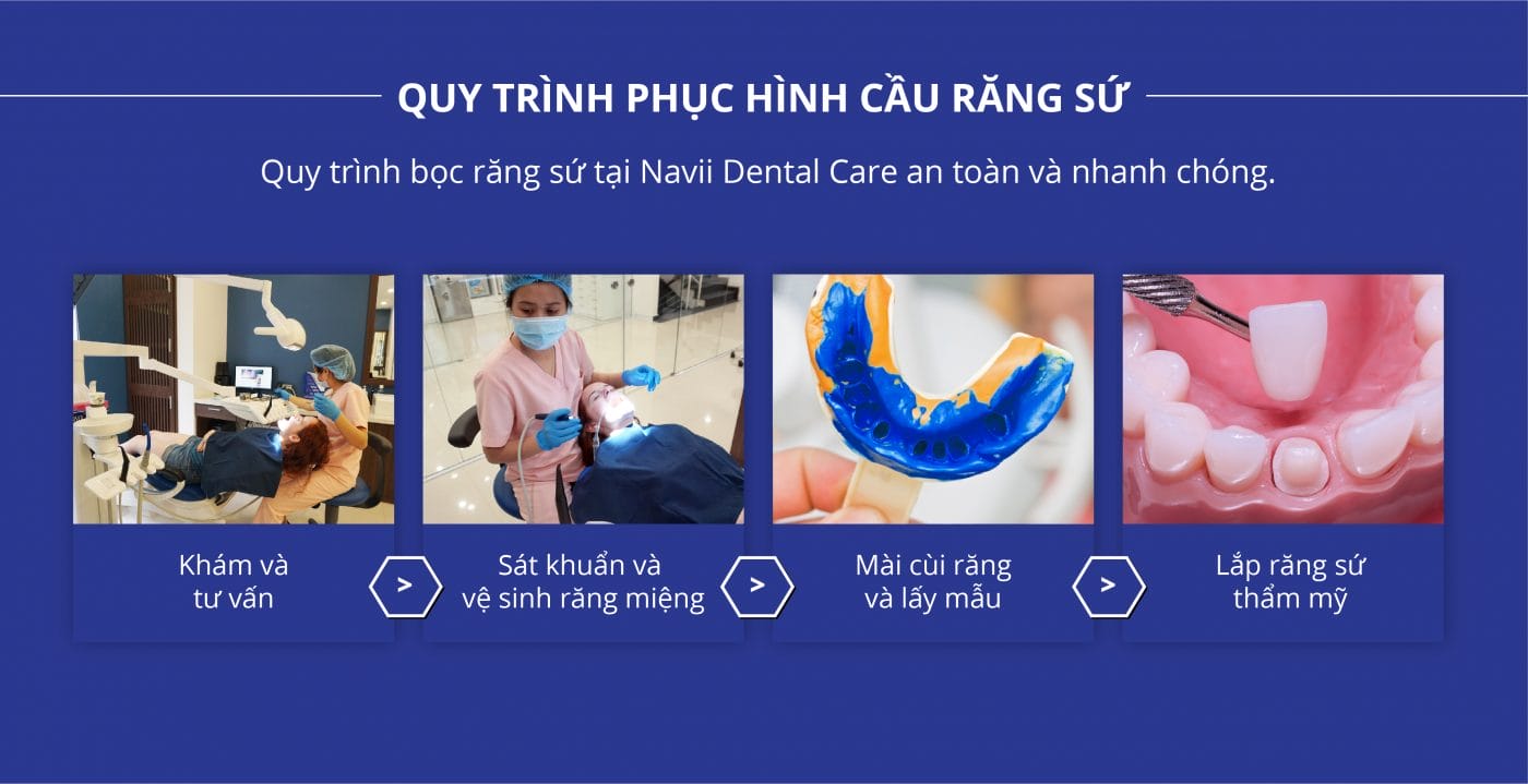 Navii Dental Care