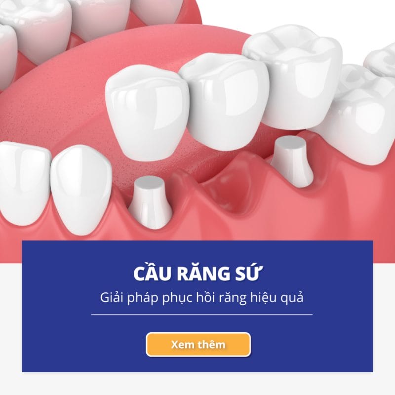 Navii Dental Care