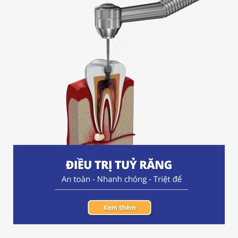 Navii Dental Care