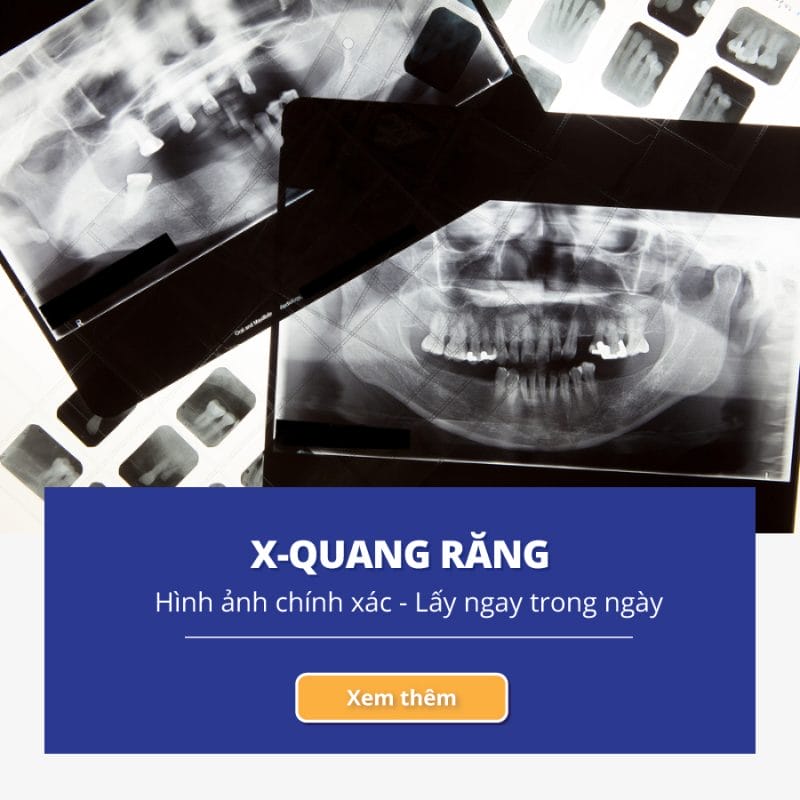 Navii Dental Care