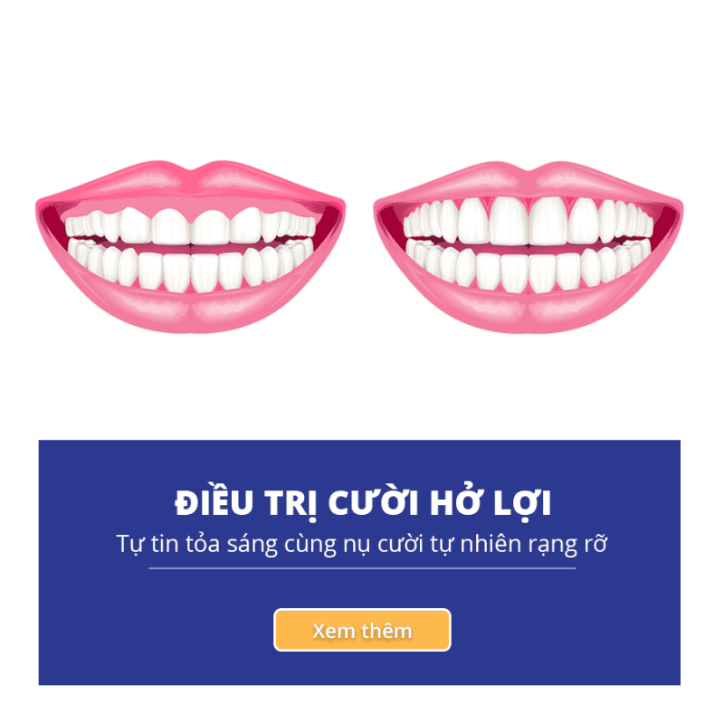 Navii Dental Care