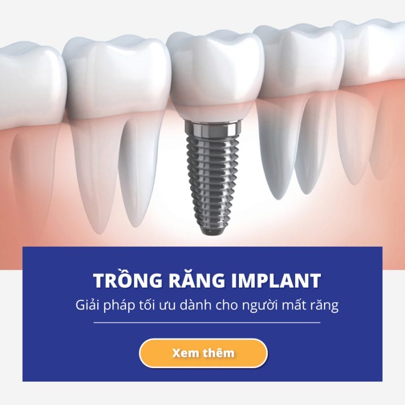 Navii Dental Care