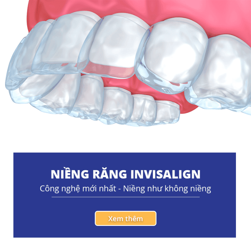Navii Dental Care