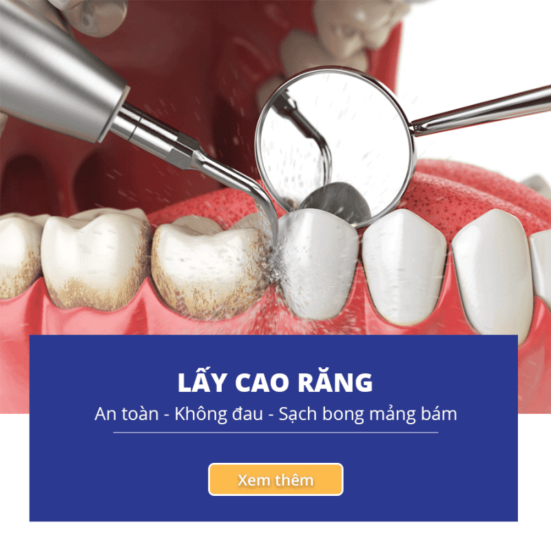 Navii Dental Care