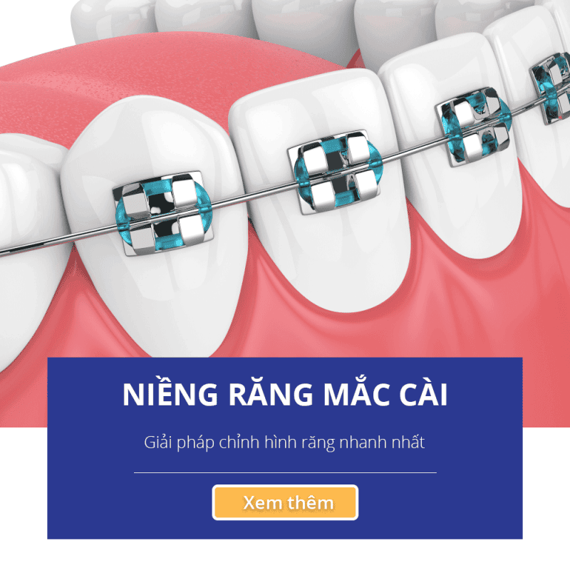 Navii Dental Care