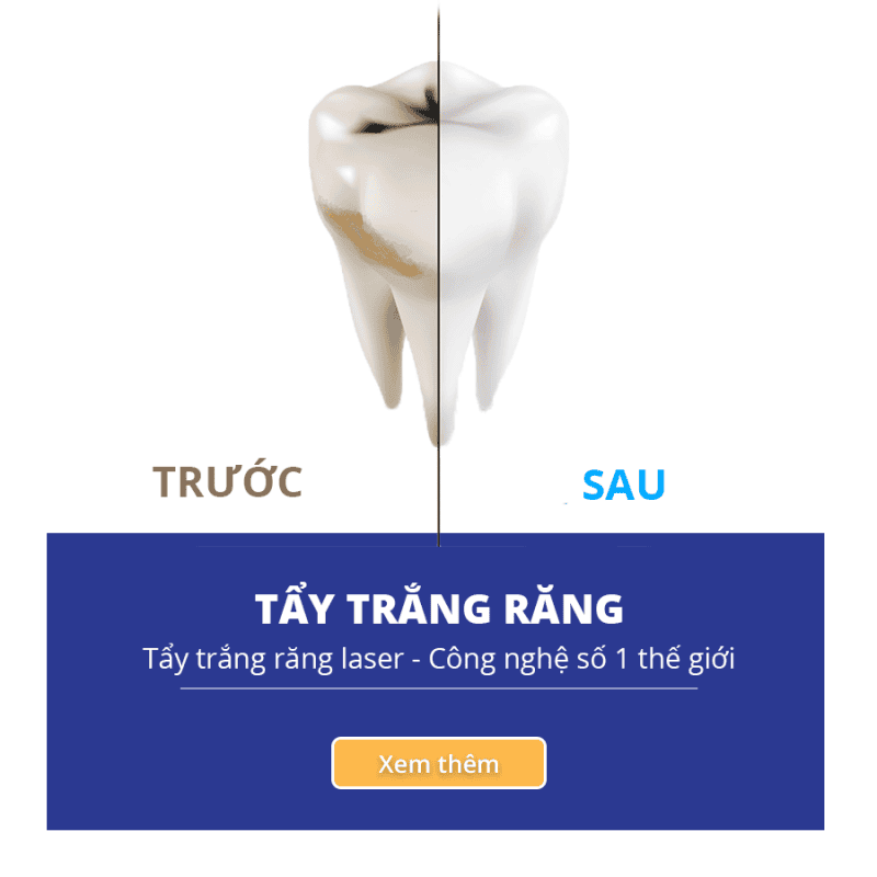 Navii Dental Care