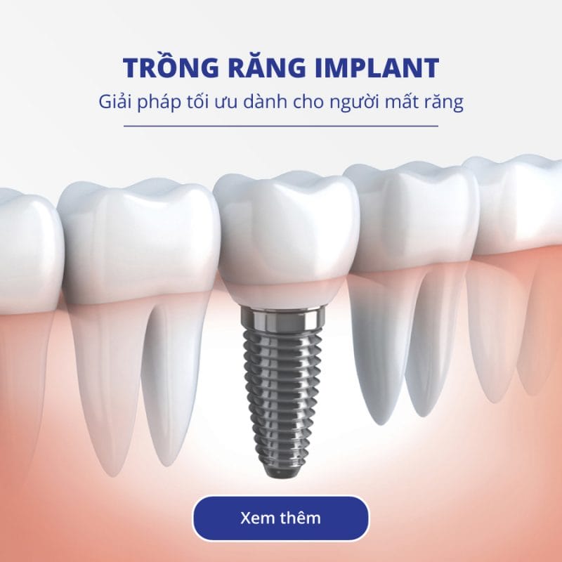 Navii Dental Care