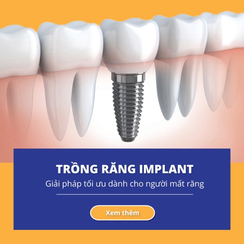 Navii Dental Care