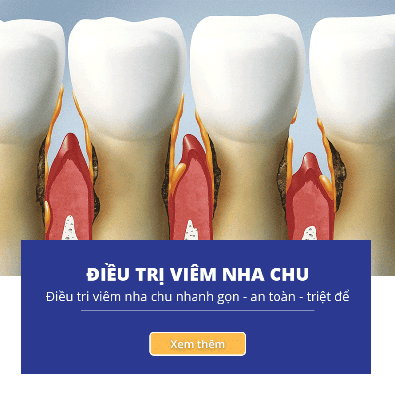 Navii Dental Care