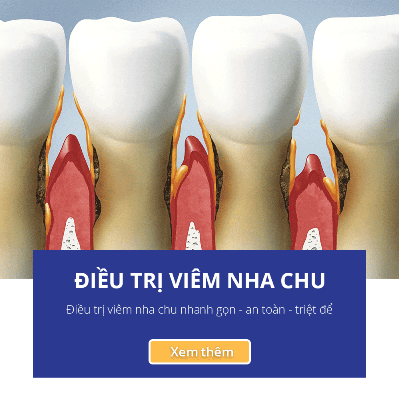 Navii Dental Care