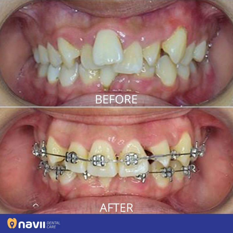 Navii Dental Care