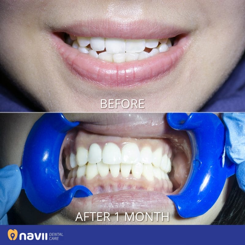 Navii Dental Care