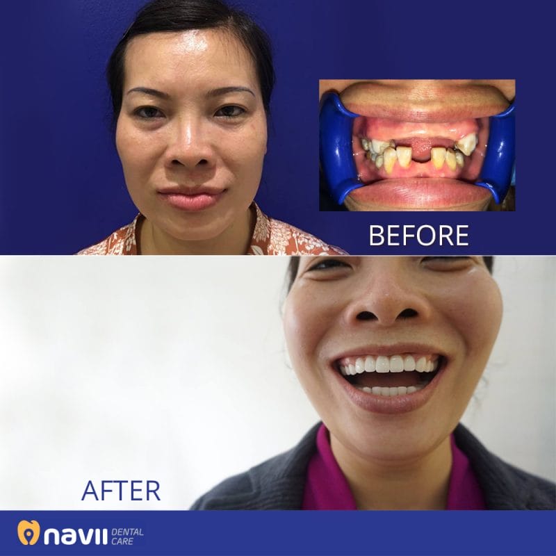 Navii Dental Care