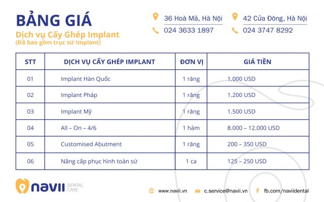 gia_dich_vu_trong_rang_implant