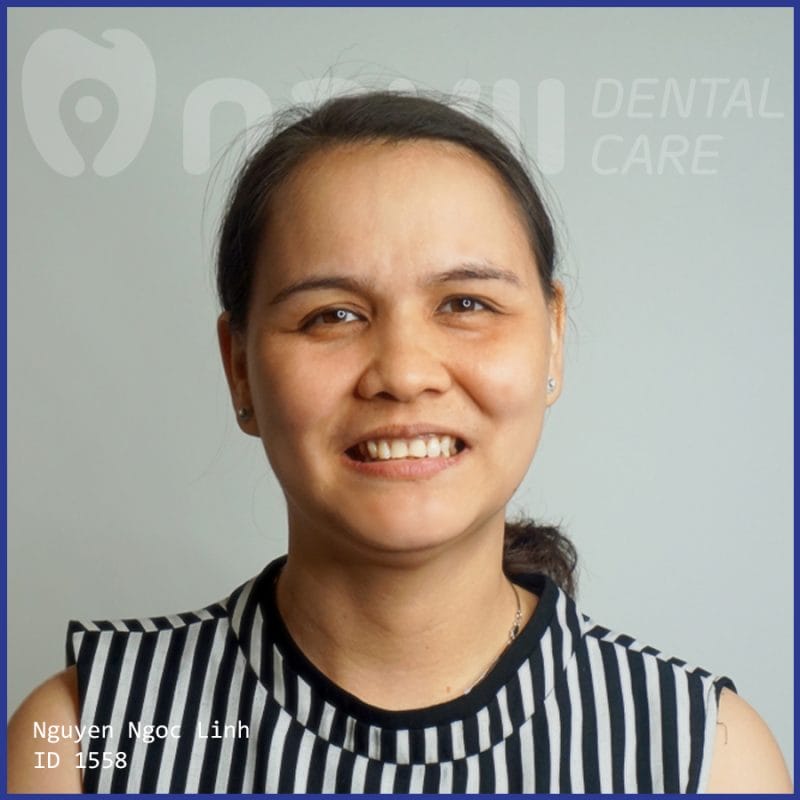 nhổ răng review