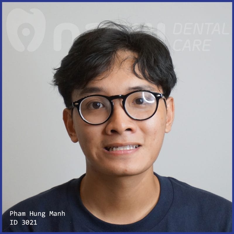 càu răng sứ review