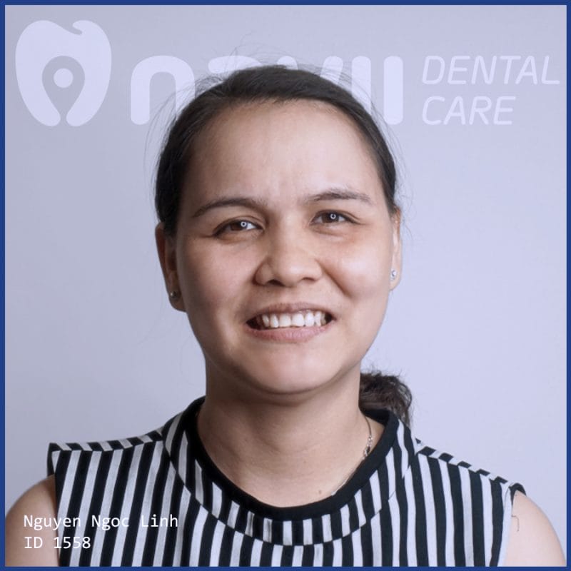 nho-rang-gia-bao-nhieu-tien