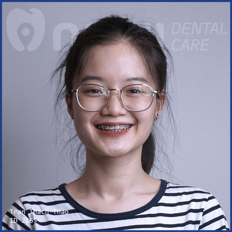 nieng-rang-co-dau-khong