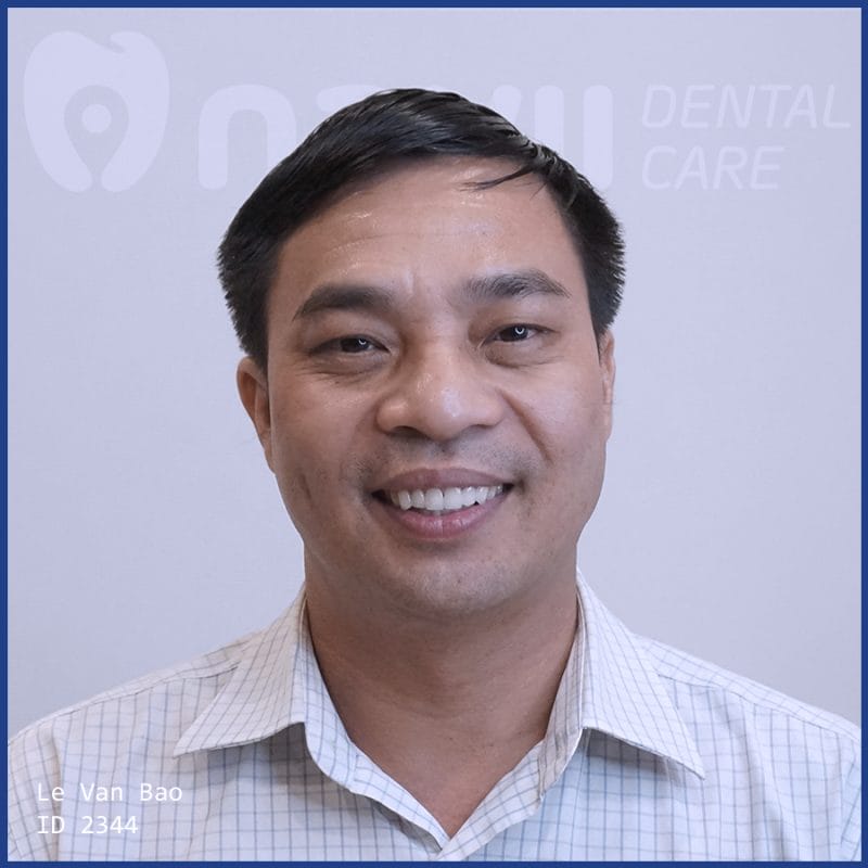 boc-rang-su-gia-bao-nhieu