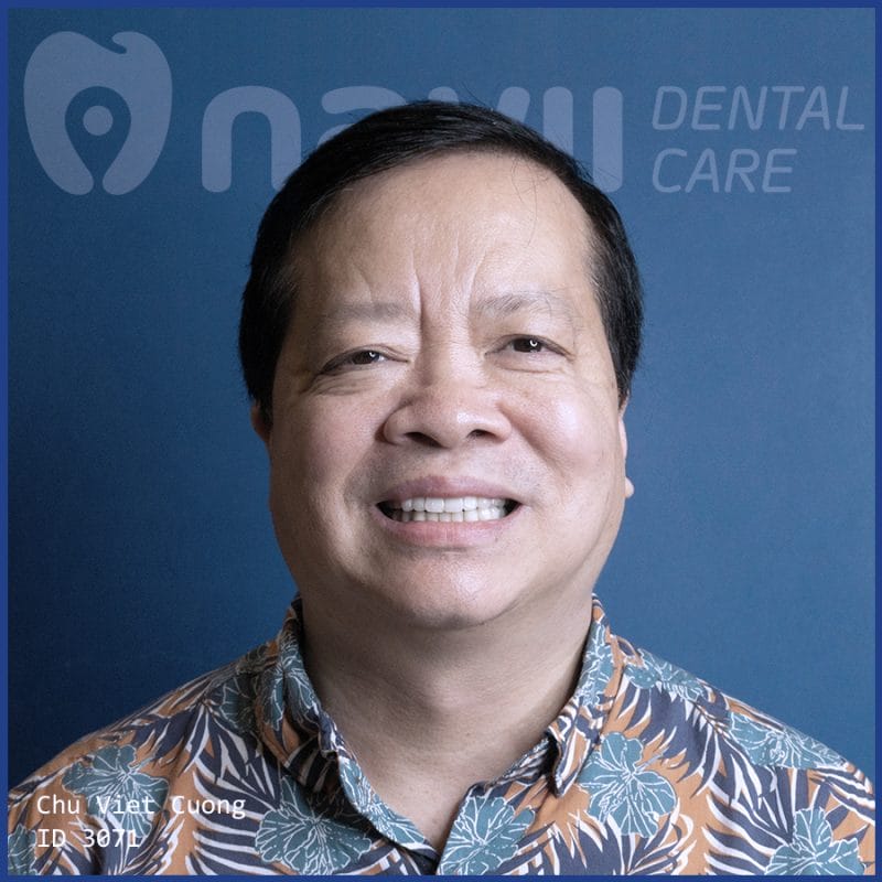 boc-rang-su-o-dau-tot