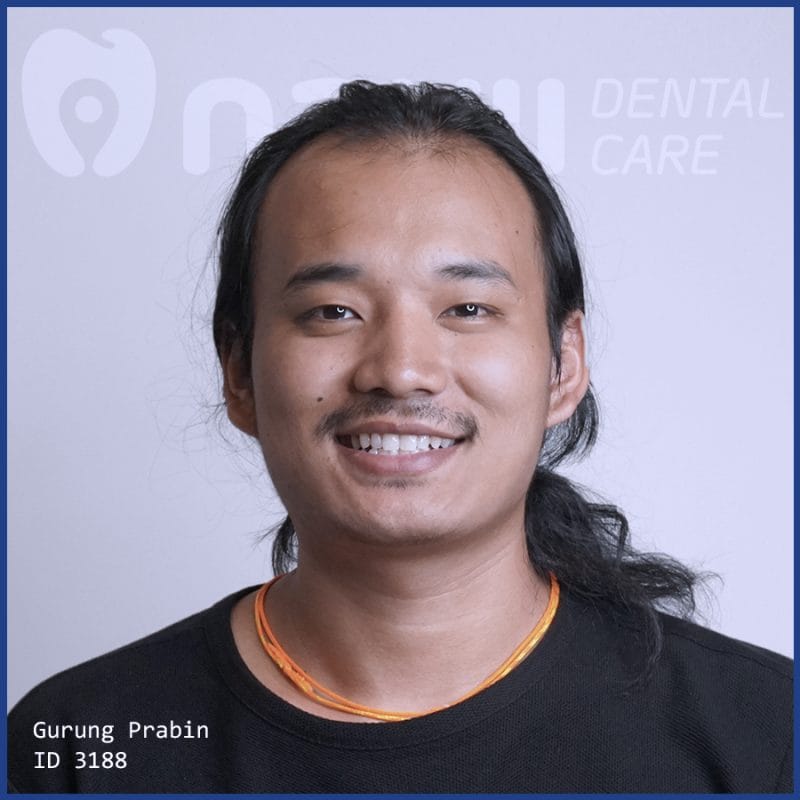 dieu-tri-tuy-gia-bao-nhieu