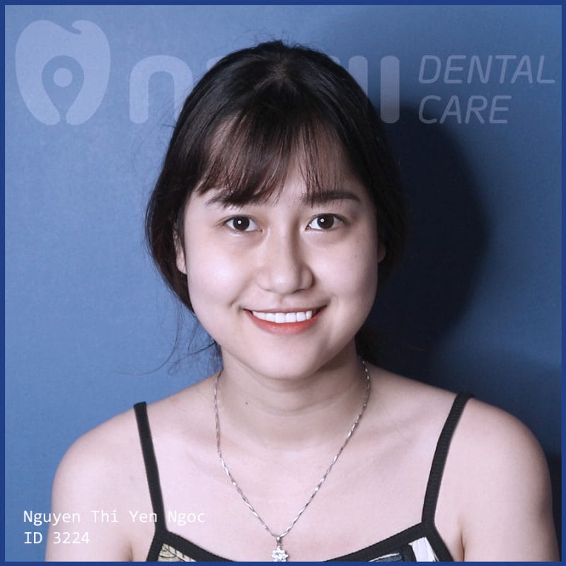 tay-trang-rang-gia-bao-nhieu