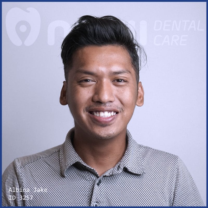 nho-rang-khon-gia-bao-nhieu