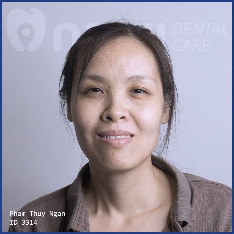 lam-cau-rang-su-o-dau-tot